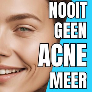 nooit geen acne meer